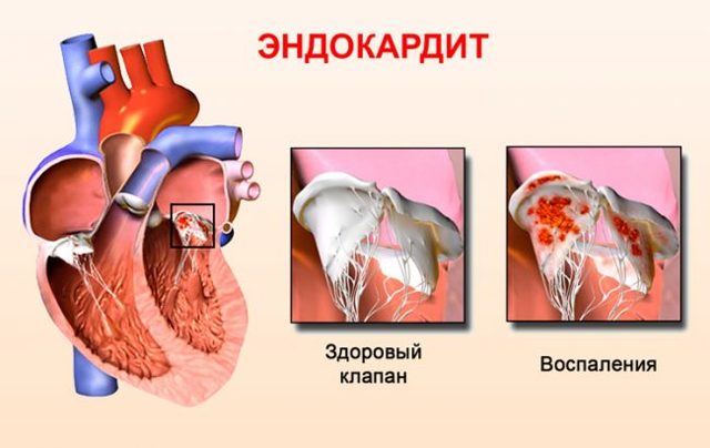 Симптомы болезни у собаки. Как узнать, что питомцу нездоровится?